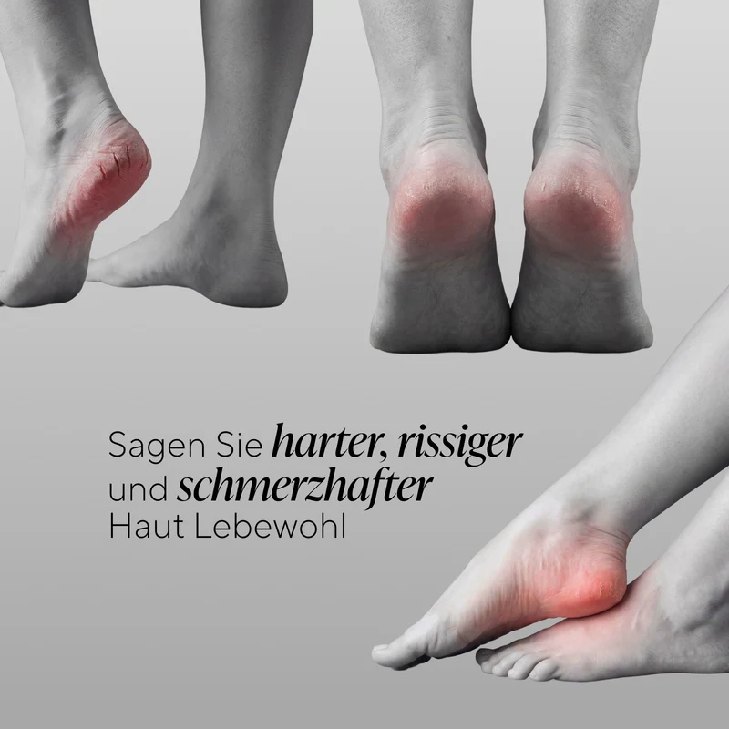 Elektrischer Hornhautentferner PediGlow I Pro Series