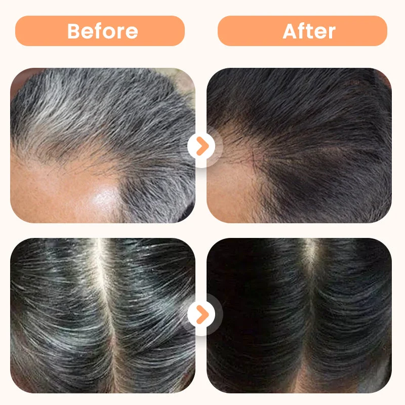 🔥🥰Haarfärbemittel mit Pflanzenextrakten für graues Haar