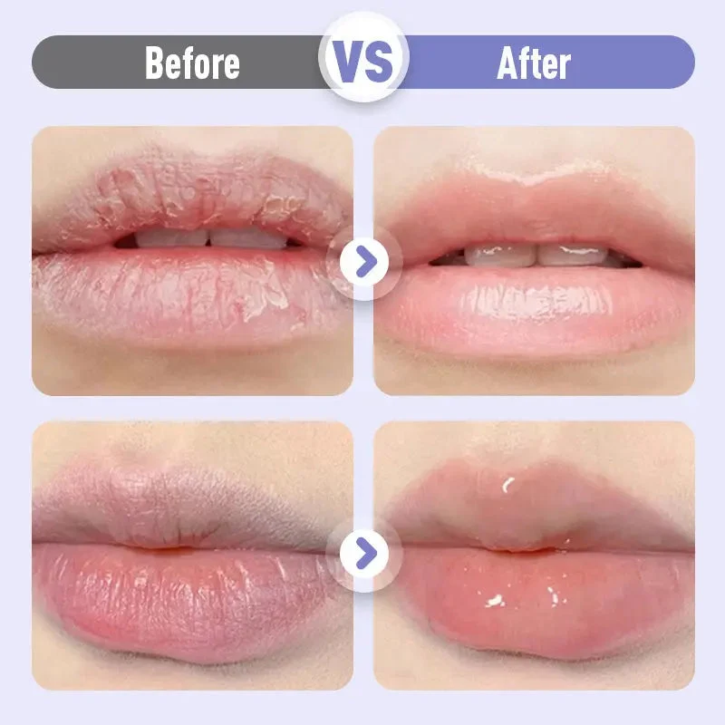 🎁 Kaufe 2, erhalte 1 GRATIS! 💄✨ Aufpolsterndes und feuchtigkeitsspendendes Lippenserum gegen Falten