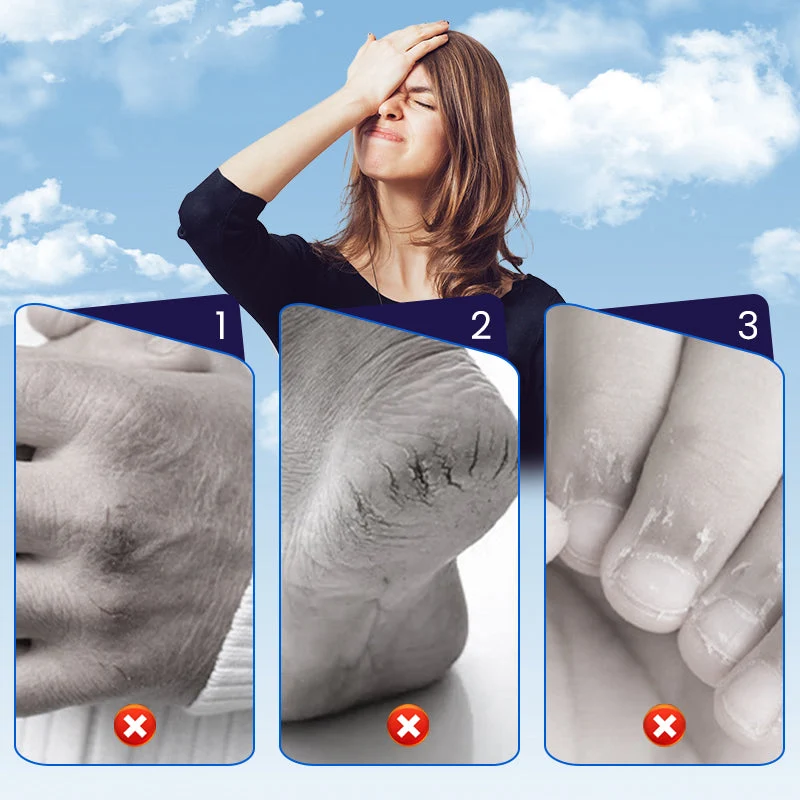 💧Rissige-Haut-Reparaturpflaster für Hände & Füße (50 % RABATT)