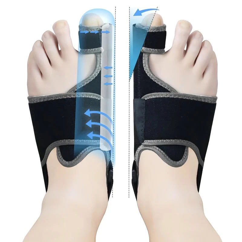 Skanto | Verstellbarer Hallux Valgus Korrektor