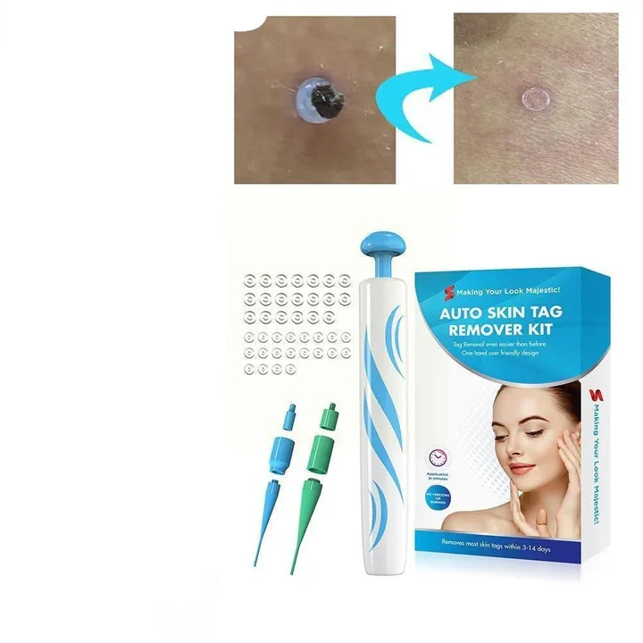 Skanto | DermaClear Warzenentferner | Schmerzfrei | Kompakt & Hygienisch | Für Männer & Frauen