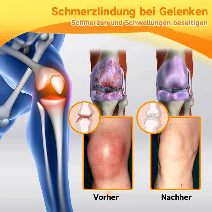Bee Vital Creme | Schnelle Schmerzlinderung | Skanto