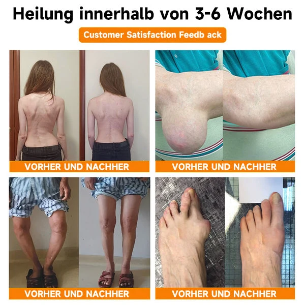 Bee Vital Creme | Schnelle Schmerzlinderung | Skanto
