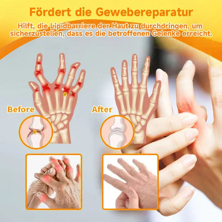 Bee Vital Creme | Schnelle Schmerzlinderung | Skanto