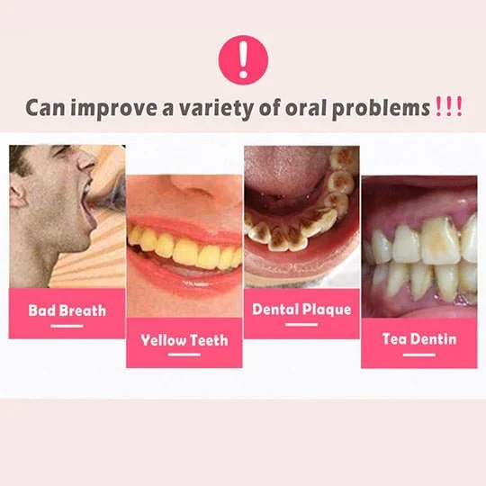 Skanto | SMILEPRO – Schallzahnbürste mit Ultraschalltechnologie für tiefe Mundhygiene