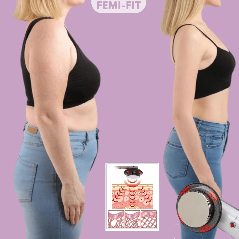 Skanto | SlimShape – 3-in-1 Cellulite- & Fettverbrenner mit EMS, Ultraschall & Infrarotlicht